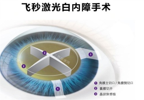 香港大学深圳医院眼科靠谱吗？国内外化团队+早产儿视网膜病变筛查比较靠前！​​