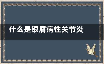 什么是银屑病性关节炎(银屑病都有什么类型)