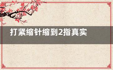打紧缩针缩到2指真实反馈：5个月无反弹，医生手法更关键！