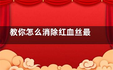 教你怎么消除红血丝最有效果