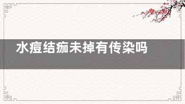 水痘结痂未掉有传染吗(水痘结痂未掉有传染吗已经21天了)