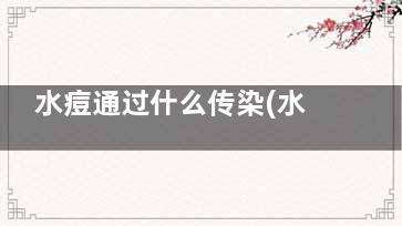 水痘通过什么传染(水痘可以通过什么传播)