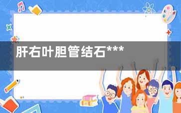 肝右叶胆管结石***吗(肝右叶胆管结石或钙化是什么意思)