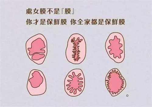 处女膜形状动画演示图
