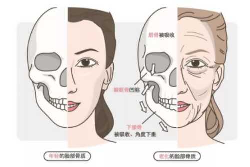 年轻、年老脸部骨骼对比图