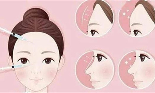 面部注射对比图 面部注射对比图