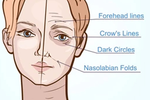 人体衰老形成的不同皱纹 人体衰老形成的不同皱纹