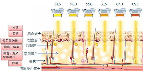 光子嫩肤原理图 光子嫩肤原理图