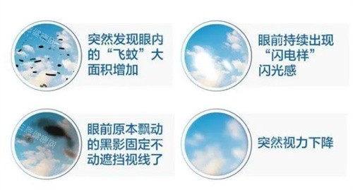 飞蚊症的前期症状