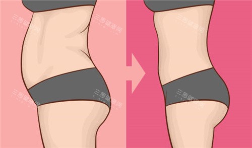 腹部吸脂对比动画