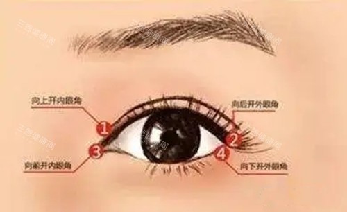 开内外眼角