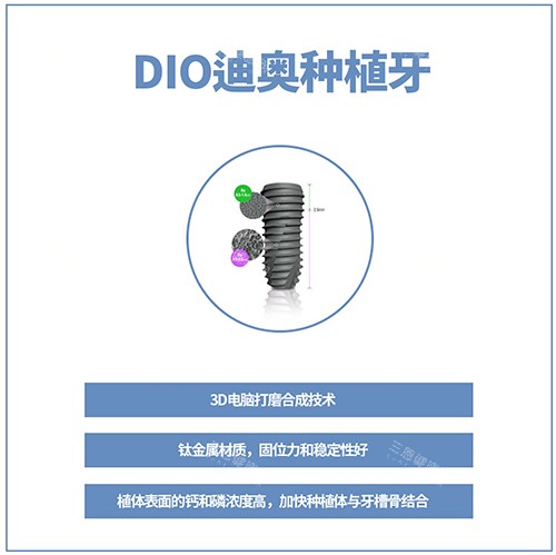 韩国DIO种植牙讲解图