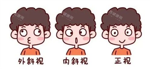 外斜内斜和正常眼睛的对比图
