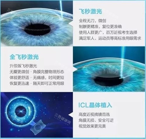 不同近视手术的区别 不同近视手术的区别