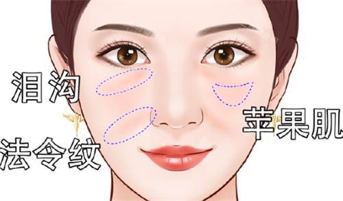 面部凹陷之后所呈现的面部状态 面部凹陷之后所呈现的面部状态