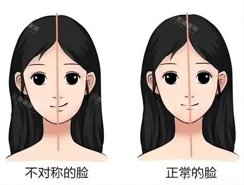 面部不对称与正常的脸对比动画图 面部不对称与正常的脸对比动画图