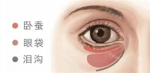 卧蚕眼袋泪沟的区别 卧蚕眼袋泪沟的区别