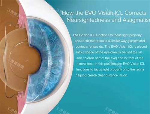 什么是人工晶体 什么是人工晶体