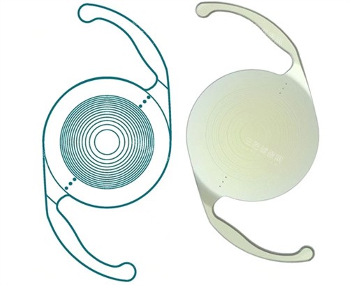 三焦点人工晶体图片 三焦点人工晶体图片