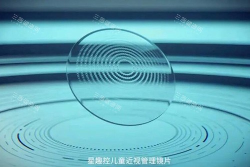 星趣控儿童近视管理镜片 星趣控儿童近视管理镜片