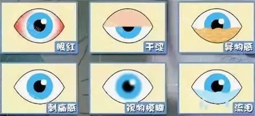 眼部疾病明细图 眼部疾病明细图