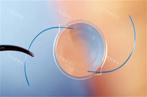 白内障人工晶体 白内障人工晶体
