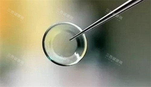 rgp镜片