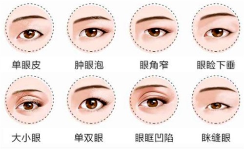 眼部整形适应症展示