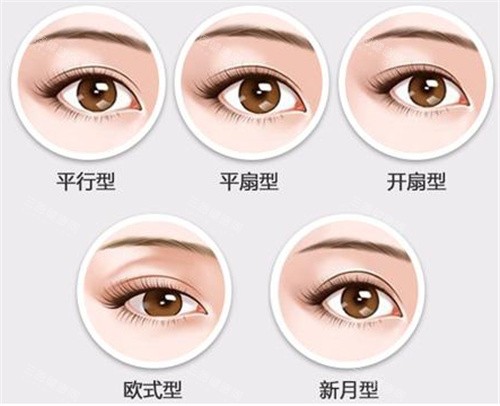 双眼皮的不同形态