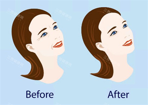 针剂注射前后图