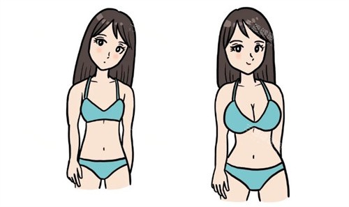 隆胸前后对比卡通 隆胸前后对比卡通
