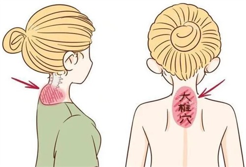 改善富贵包前后对比 改善富贵包前后对比