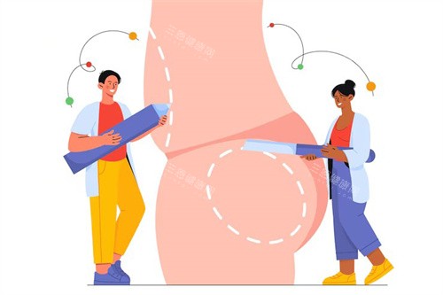 臀部整形卡通 臀部整形卡通