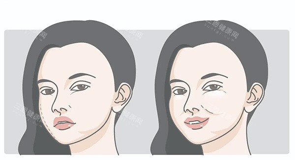 馒化脸对比照片 馒化脸对比照片