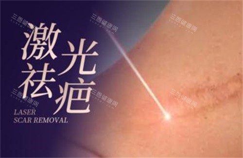 激光祛疤改善照片