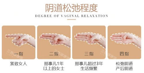 阴道松弛程度图示