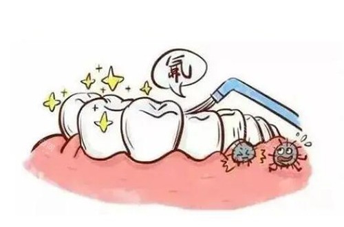 儿童口腔涂氟改善