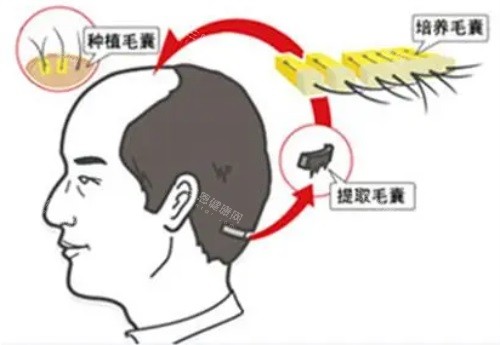 南京萝爱美丽再生做什么好?做植发很不错!3D高密/微针/FUE植发都不错,收费也擅长