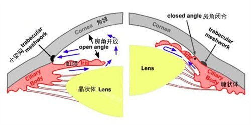 乌鲁木齐青光眼眼科排行比较新发布！普瑞高新院、爱尔阿迪娅、美尼康哪家技术更靠谱？