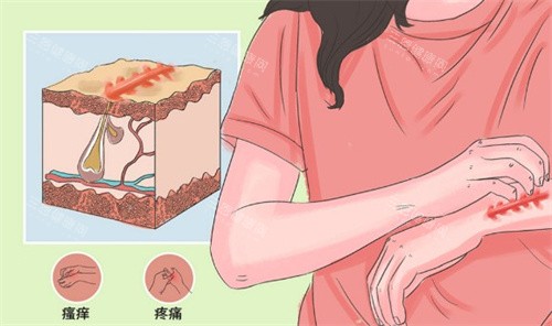 成都医附大疤痕修复怎么样？整友评价好还会推荐朋友，揭晓疤痕修复技术、成效、医生团队等