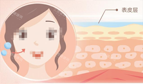 润洛薇玻尿酸是什么档次？和乔雅登、瑞蓝比怎么样？性价比高吗？