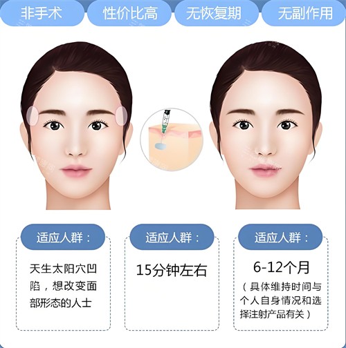 玻尿酸注射填充适合人群与原理动画图