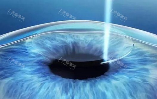 惠州爱尔眼科麦地门诊部详细简介+在线预约挂号方式，客观分析医院好不好及诊疗优势
