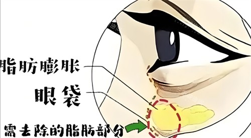 2025锡林郭勒盟中心医院 (医学美容科) 价格更新：双眼皮3000+假体隆胸18000+吸脂5800+