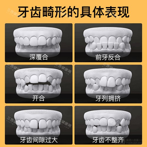正畸2x4矫正技术具体步骤解析！适合哪些人？操作细节+术后护理全说明