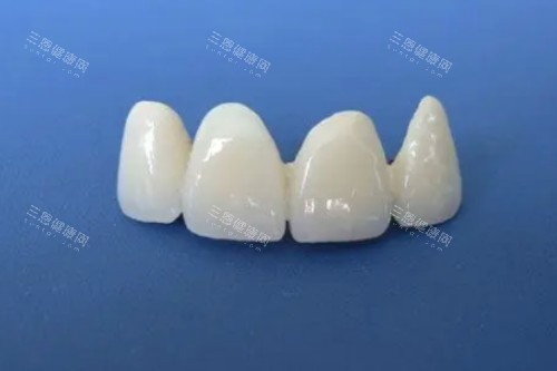 全瓷牙模型展示图