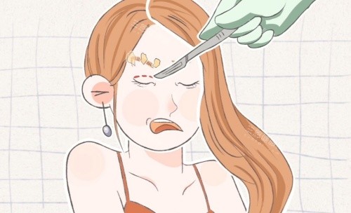 蚌埠修复双眼皮哪家强？医生对比+真实反馈，选对不踩雷，这份攻略请收好！