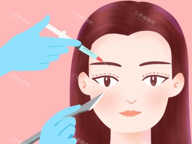双眼皮画线展示图