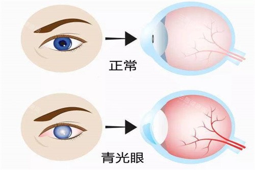重庆2025年眼科医院价格更新：华厦近视手术1.2万/爱尔白内障3000元起，哪家更划算？