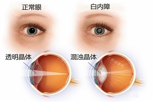 上海五官科医院眼科预约挂号，微信、电话、平台预约，热门医生号需提前抢